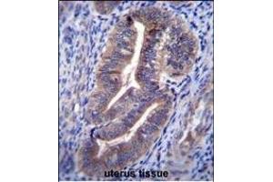 Immunohistochemistry (Paraffin-embedded Sections) (IHC (p)) image for anti-Endosome/Lysosome-associated Apoptosis and Autophagy Regulator 1 (ELAPOR1) (AA 704-732), (C-Term) antibody (ABIN656481)