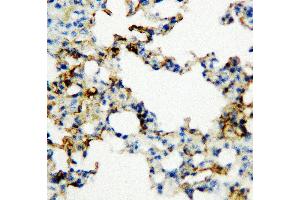 Anti-RAGE antibody, IHC(P) IHC(P): Rat Lung Tissue (RAGE 抗体  (Middle Region))