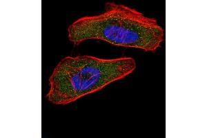 Immunofluorescence (IF) image for anti-Hypoxia Inducible Factor 1, alpha Subunit (Basic Helix-Loop-Helix Transcription Factor) (HIF1A) (AA 1-30), (N-Term) antibody (ABIN650972)