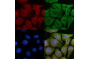 ABIN6257173 and ABIN6274284 staining Hela cells(45 min of heat-shock) by IF/ICC.