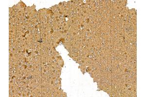 ABIN7094459 and ABIN7098507 at 1/100 staining Rat brain tissue by IHC-P.