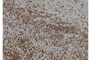 ABIN6261818 and ABIN6278680 at 1/100 staining Human spleen tissue by IHC-P.