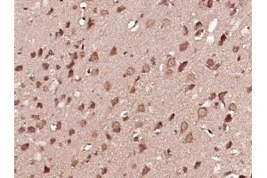 Immunohistochemistry (Paraffin-embedded Sections) (IHC (p)) image for anti-Mitogen-Activated Protein Kinase Kinase 1 (MAP2K1) (pThr286) antibody (ABIN743798)