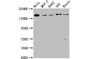 Western Blot Positive WB detected in: Hela whole cell lysate, MCF-7 whole cell lysate, K562 whole cell lysate, U87 whole cell lysate, Rat brain tissue All lanes: RAD54L2 antibody at 3. (ARIP4 抗体  (AA 1122-1296))