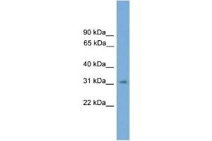 Human 721_B; WB Suggested Anti-SPRY3 Antibody Titration: 0. (SPRY3 抗体  (N-Term))