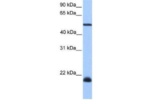 Western Blotting (WB) image for anti-Dyslexia Susceptibility 1 Candidate 1 (DYX1C1) antibody (ABIN2459540) (DYX1C1 抗体)