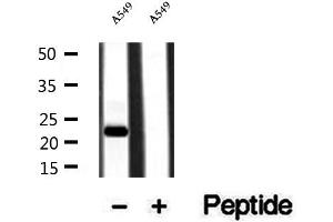Western blot analysis of extracts of A549 cells, using PPPDE1/PNAS4 antibody. (PPPDE1 抗体  (Internal Region))