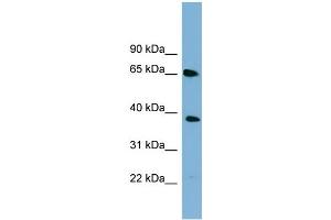 WB Suggested Anti-GNL3 Antibody Titration: 0. (Nucleostemin 抗体  (Middle Region))