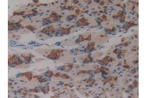 Detection of ASGR1 in Mouse Stomach Tissue using Polyclonal Antibody to Asialoglycoprotein Receptor 1 (ASGR1) (Asialoglycoprotein Receptor 1 抗体  (AA 80-281))