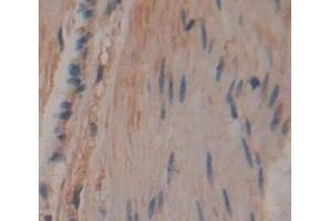 IHC-P analysis of Human Tissue, with DAB staining. (CCDC80 抗体  (AA 81-258))