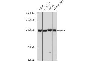 Western blot analysis of extracts of various cell lines, using eEF2 Rabbit mAb (ABIN7267025) at 1:1000 dilution. (EEF2 抗体)