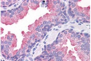 Human Prostate: Formalin-Fixed, Paraffin-Embedded (FFPE) (TMEM184A 抗体  (C-Term))