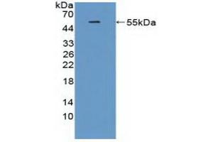 Detection of Recombinant TREM2, Rat using Polyclonal Antibody to Triggering Receptor Expressed On Myeloid Cells 2 (TREM2) (TREM2 抗体  (AA 1-228))