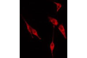 ABIN6274614 staining Hela cells by IF/ICC. (CDC20 抗体  (N-Term))