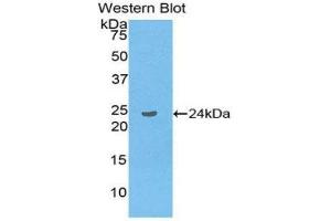 Western Blotting (WB) image for anti-Linker For Activation of T Cells Family, Member 2 (LAT2) (AA 30-209) antibody (ABIN3202070) (LAT2 抗体  (AA 30-209))
