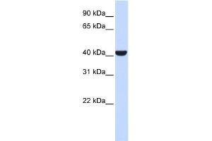 WB Suggested Anti-ERLIN2 Antibody Titration: 0. (ERLIN2 抗体  (Middle Region))