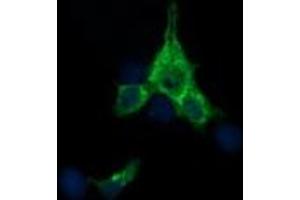 Image no. 4 for anti-Synaptophysin (SYP) antibody (ABIN1501256) (Synaptophysin 抗体)