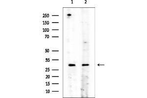anti-ST3 beta-Galactoside alpha-2,3-Sialyltransferase 4 (ST3GAL4) antibody