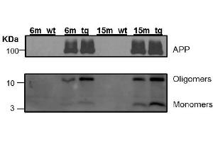 Western Blotting (WB) image for anti-Amyloid beta (Abeta) (C-Term) antibody (ABIN5508784)