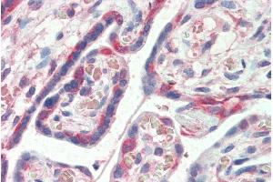 ABIN185153 (5µg/ml) staining of paraffin embedded Human Placenta. (PDLIM1 抗体  (C-Term))