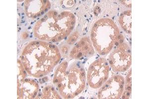 Used in DAB staining on fromalin fixed paraffin- embedded Kidney tissue (NCK1 抗体  (AA 2-377))