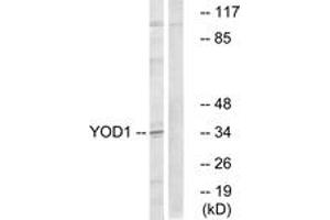 Western blot analysis of extracts from COLO cells, using YOD1 Antibody. (YOD1 抗体  (AA 116-165))