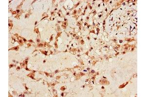 Immunohistochemistry of paraffin-embedded human placenta tissue using ABIN7156360 at dilution of 1:100 (IGF2BP3 抗体  (AA 1-100))