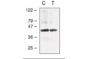 Western blot analysis of Arabidopsis chloroplast (C) and thylakoid (T) proteins with anti-CF1gamma (AtpC). (ATP Synthase Subunit gamma (AtpC) 抗体)