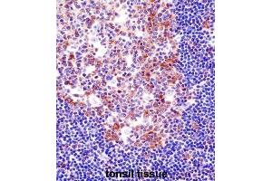 Immunohistochemistry (IHC) image for anti-Spleen Focus Forming Virus (SFFV) Proviral Integration Oncogene Spi1 (SPI1) antibody (ABIN2998289) (SPI1 抗体)