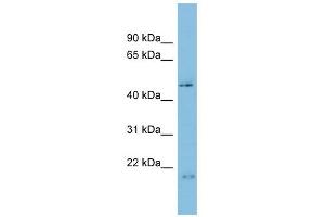 C17orf75 antibody used at 1 ug/ml to detect target protein. (C17orf75 抗体  (N-Term))