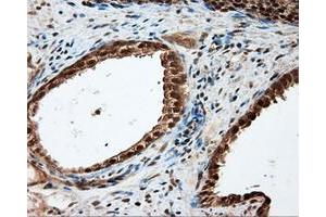 Immunohistochemical staining of paraffin-embedded liver tissue using anti-LIPG mouse monoclonal antibody. (LIPG 抗体)
