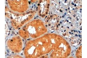 ABIN2564355 (2µg/ml) staining of paraffin embedded Human Kidney. (RPS6KB1 抗体  (C-Term))