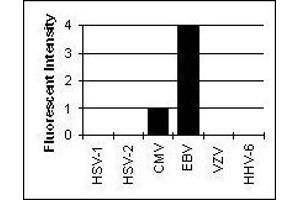 Cross Reactivity Results determined by IFA (EBV-Gp350 抗体)