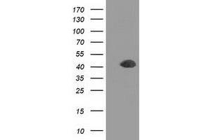 Western Blotting (WB) image for anti-Doublecortin (DCX) antibody (ABIN1497783) (Doublecortin 抗体)
