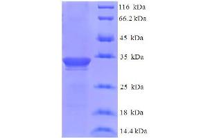 Dysbindin (Dystrobrevin Binding Protein 1) Domain Containing 2 (DBNDD2) (AA 1-161) protein (His-SUMO Tag)