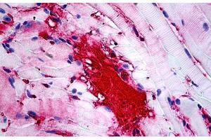 Mouse Muscle: Formalin-Fixed, Paraffin-Embedded (FFPE) (APOA1 抗体)