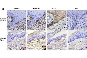 Expression patterns of vimentin, α-SMA, and P311 in the epidermis of human burn wounds. (NREP 抗体  (AA 25-68))