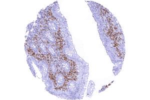 In the appendix CD38 staining occurs in various inflammatory cells while the epithelial cells remain CD38 negative (Recombinant CD38 抗体  (AA 190-310))