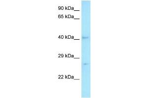 WB Suggested Anti-MED7 Antibody   Titration: 1. (MED7 抗体  (C-Term))