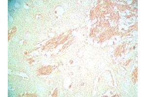 Mouse brain tissue was stained by Rabbit Anti-Metasin (1-25) / KISS-1 (68-92) (Human) Serum (KISS1 抗体  (AA 1-25, AA 68-92))