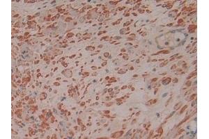 Detection of RI in Human Prostate Tissue using Polyclonal Antibody to Ribonuclease Inhibitor (RI) (RNH1 抗体  (AA 218-444))