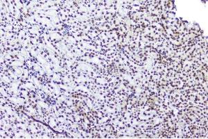 IHC analysis of TPR using anti-TPR antibody (ABIN5693275). (TPR 抗体)