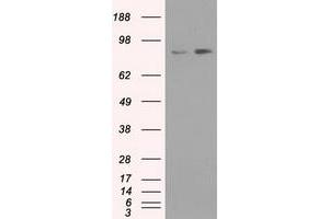 Western Blotting (WB) image for anti-Neurotrophic tyrosine Kinase, Receptor, Type 3 (NTRK3) antibody (ABIN1499843) (NTRK3 抗体)