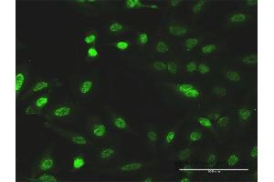 Immunofluorescence of monoclonal antibody to CITED1 on HeLa cell. (CITED1 抗体  (AA 1-193))