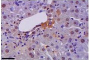 Representative immunohistochemistry of HM GB1 (brown) in liver during hepatitis. (HMGB1 抗体)