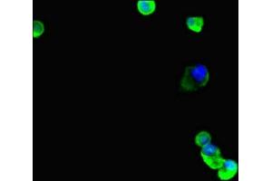 Immunofluorescent analysis of MCF-7 cells using ABIN7173691 at dilution of 1:100 and Alexa Fluor 488-congugated AffiniPure Goat Anti-Rabbit IgG(H+L) (TUBB4 抗体  (AA 1-444))