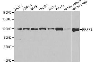Western blot analysis of extracts of various cell lines, using PRPF3 antibody. (PRPF3 抗体  (AA 1-280))
