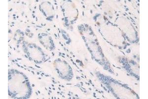 Immunohistochemistry (IHC) image for anti-Interleukin 12 alpha (IL12A) (AA 23-219) antibody (ABIN7430651)