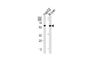 GCK Antibody (M1) (ABIN392390 and ABIN2842018) western blot analysis in HepG2 cell line and rat liver lysates (35 μg/lane). (GCK 抗体  (N-Term))