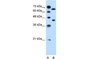 WB Suggested Anti-SLCO1A2 Antibody Titration:  0. (SLCO1A2 抗体  (Middle Region))
